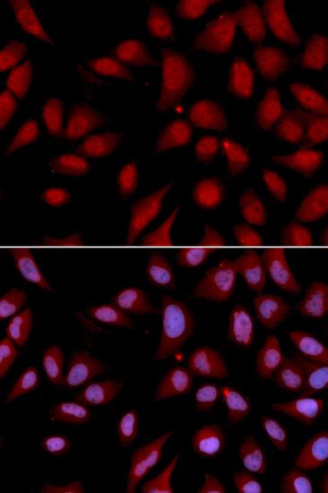 Immunocytochemistry/ Immunofluorescence: DLG7/HURP Antibody [NBP3-37984] - Immunofluorescence analysis of U2OS cells using DLG7/HURP Rabbit pAb. Secondary antibody: Cy3-conjugated Goat anti-Rabbit IgG (H+L) at 1:500 dilution. Blue: DAPI for nuclear staining.