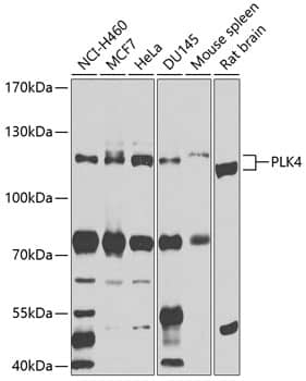 Western Blot: PLK4 Antibody [NBP3-37985] - Western blot analysis of various lysates using PLK4 Rabbit pAb at 1:1000 dilution.Secondary antibody: HRP-conjugated Goat anti-Rabbit IgG (H+L) at 1:10000 dilution.Lysates/proteins: 25ug per lane.Blocking buffer: 3% nonfat dry milk in TBST.Detection: ECL Basic Kit.Exposure time: 15s.