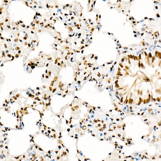 Immunohistochemistry: KAT2A/GCN5 Antibody [NBP3-37988] - Immunohistochemistry analysis of paraffin-embedded Rat lung using KAT2A/GCN5 Rabbit pAb at dilution of 1:50 (40x lens). High pressure antigen retrieval performed with 0.01M Citrate Bufferr (pH 6.0) prior to IHC staining.