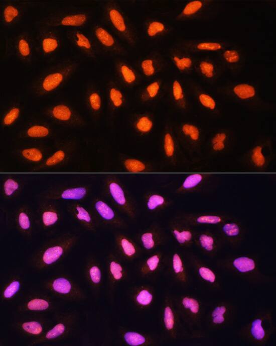 Immunocytochemistry/ Immunofluorescence KAT2A/GCN5 Antibody