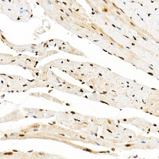 Immunohistochemistry KAT2A/GCN5 Antibody