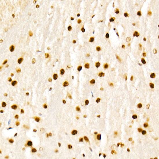 Immunohistochemistry KAT2A/GCN5 Antibody