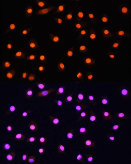 Immunocytochemistry/ Immunofluorescence: KAT2A/GCN5 Antibody [NBP3-37988] - Immunofluorescence analysis of L929 cells using KAT2A/GCN5 Rabbit pAb at dilution of 1:100 (40x lens). Secondary antibody: Cy3-conjugated Goat anti-Rabbit IgG (H+L) at 1:500 dilution. Blue: DAPI for nuclear staining.