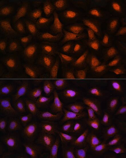 Immunocytochemistry/ Immunofluorescence: CTBP2 Antibody [NBP3-37989] - Immunofluorescence analysis of U2OS cells using CTBP2 Rabbit pAb at dilution of 1:100. Secondary antibody: Cy3-conjugated Goat anti-Rabbit IgG (H+L) at 1:500 dilution. Blue: DAPI for nuclear staining.