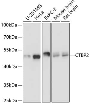 Western Blot: CTBP2 Antibody [NBP3-37989] - Western blot analysis of various lysates using CTBP2 Rabbit pAb at 1:3000 dilution.Secondary antibody: HRP-conjugated Goat anti-Rabbit IgG (H+L) at 1:10000 dilution.Lysates/proteins: 25ug per lane.Blocking buffer: 3% nonfat dry milk in TBST.Detection: ECL Basic Kit.Exposure time: 1s.