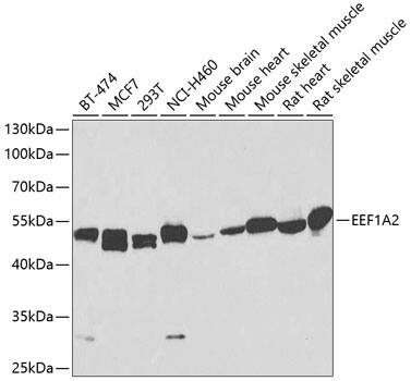 Western Blot: EEF1A2 Antibody [NBP3-37995] - Western blot analysis of various lysates using EEF1A2 Rabbit pAb at 1:1000 dilution.Secondary antibody: HRP-conjugated Goat anti-Rabbit IgG (H+L) at 1:10000 dilution.Lysates/proteins: 25ug per lane.Blocking buffer: 3% nonfat dry milk in TBST.Detection: ECL Basic Kit.Exposure time: 90s.