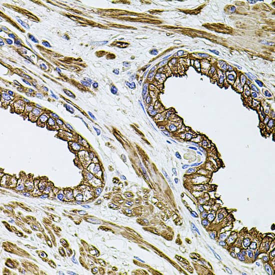 Immunohistochemistry: Filamin B Antibody [NBP3-37996] - Immunohistochemistry analysis of paraffin-embedded Human prostate using Filamin B Rabbit pAb at dilution of 1:100 (40x lens). Microwave antigen retrieval performed with 0.01M PBS Buffer (pH 7.2) prior to IHC staining.