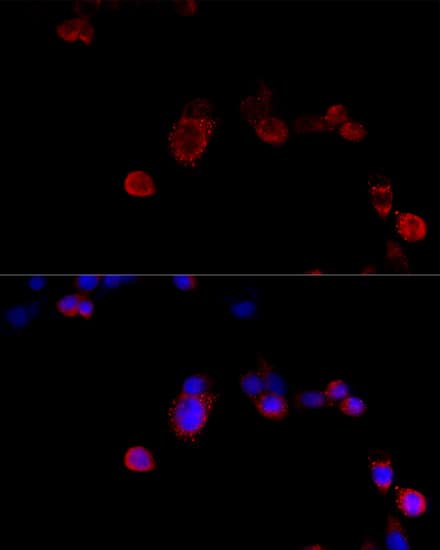 Immunocytochemistry/ Immunofluorescence: Filamin B Antibody [NBP3-37996] - Immunofluorescence analysis of NIH/3T3 cells using Filamin B Rabbit pAb at dilution of 1:100 (40x lens). Secondary antibody: Cy3-conjugated Goat anti-Rabbit IgG (H+L) at 1:500 dilution. Blue: DAPI for nuclear staining.