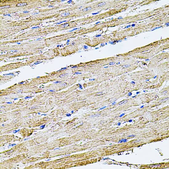 Immunohistochemistry: Filamin B Antibody [NBP3-37996] - Immunohistochemistry analysis of paraffin-embedded Rat heart using Filamin B Rabbit pAb at dilution of 1:100 (40x lens). Microwave antigen retrieval performed with 0.01M PBS Buffer (pH 7.2) prior to IHC staining.