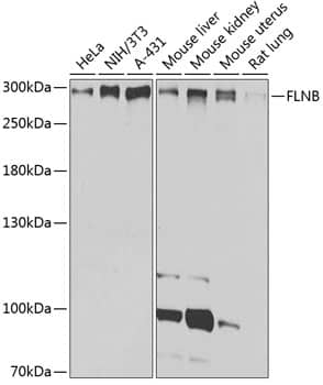 Western Blot: Filamin B Antibody [NBP3-37996] - Western blot analysis of various lysates using Filamin B Rabbit pAb at 1:1000 dilution.Secondary antibody: HRP-conjugated Goat anti-Rabbit IgG (H+L) at 1:10000 dilution.Lysates/proteins: 25ug per lane.Blocking buffer: 3% nonfat dry milk in TBST.Detection: ECL Basic Kit.Exposure time: 10s.