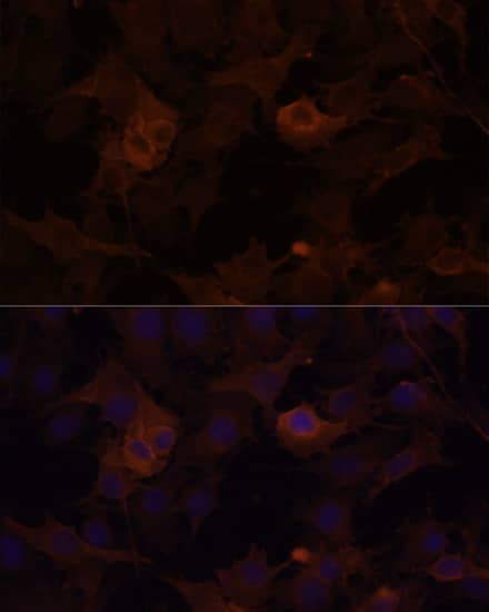 Immunocytochemistry/ Immunofluorescence: Filamin B Antibody [NBP3-37996] - Immunofluorescence analysis of HUVEC cells using Filamin B Rabbit pAb at dilution of 1:100 (40x lens). Secondary antibody: Cy3-conjugated Goat anti-Rabbit IgG (H+L) at 1:500 dilution. Blue: DAPI for nuclear staining.