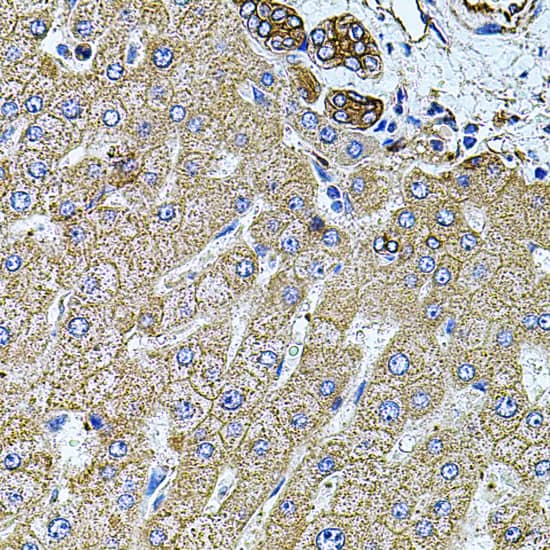 Immunohistochemistry: Filamin B Antibody [NBP3-37996] - Immunohistochemistry analysis of paraffin-embedded Human liver damage using Filamin B Rabbit pAb at dilution of 1:100 (40x lens). Microwave antigen retrieval performed with 0.01M PBS Buffer (pH 7.2) prior to IHC staining.