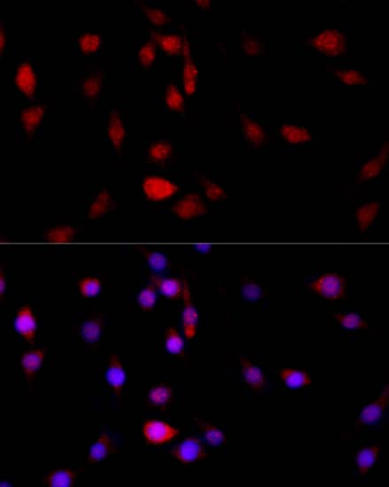 Immunocytochemistry/ Immunofluorescence: Filamin B Antibody [NBP3-37996] - Immunofluorescence analysis of PC-12 cells using Filamin B Rabbit pAb at dilution of 1:100 (40x lens). Secondary antibody: Cy3-conjugated Goat anti-Rabbit IgG (H+L) at 1:500 dilution. Blue: DAPI for nuclear staining.