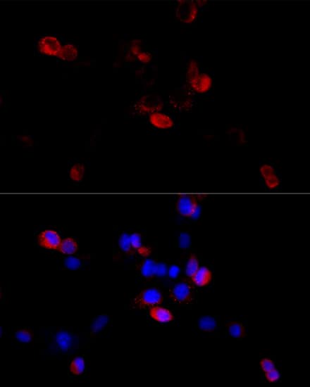 Immunocytochemistry/ Immunofluorescence: Filamin B Antibody [NBP3-37996] - Immunofluorescence analysis of HeLa cells using Filamin B Rabbit pAb at dilution of 1:100 (40x lens). Secondary antibody: Cy3-conjugated Goat anti-Rabbit IgG (H+L) at 1:500 dilution. Blue: DAPI for nuclear staining.