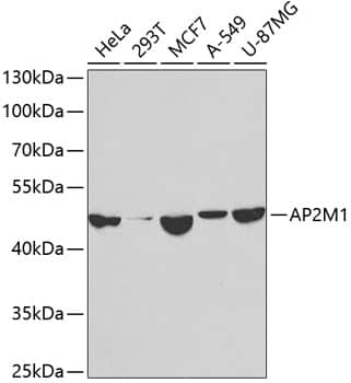 Western Blot: AP2M1 Antibody [NBP3-37998] - Western blot analysis of various lysates using AP2M1 Rabbit pAb at 1:1000 dilution.Secondary antibody: HRP-conjugated Goat anti-Rabbit IgG (H+L) at 1:10000 dilution.Lysates/proteins: 25ug per lane.Blocking buffer: 3% nonfat dry milk in TBST.