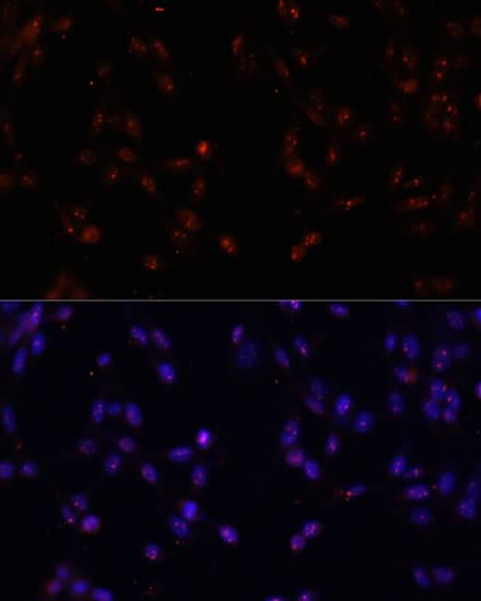 Immunocytochemistry/ Immunofluorescence ILF3 Antibody