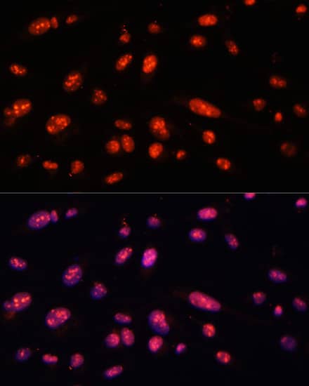 Immunocytochemistry/ Immunofluorescence ILF3 Antibody