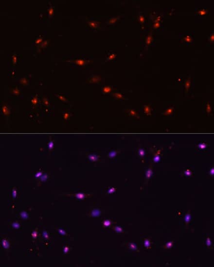 Immunocytochemistry/ Immunofluorescence ILF3 Antibody