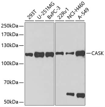 Western Blot: CASK Antibody [NBP3-38000] - Western blot analysis of various lysates using CASK Rabbit pAb at 1:1000 dilution.Secondary antibody: HRP-conjugated Goat anti-Rabbit IgG (H+L) at 1:10000 dilution.Lysates/proteins: 25ug per lane.Blocking buffer: 3% nonfat dry milk in TBST.Detection: ECL Basic Kit.Exposure time: 90s.