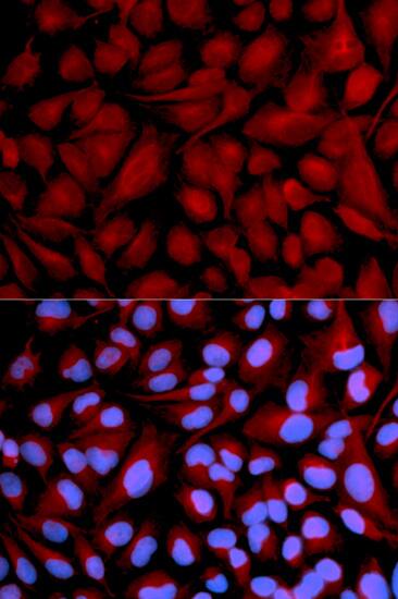 Immunocytochemistry/ Immunofluorescence: CASK Antibody [NBP3-38000] - Immunofluorescence analysis of U2OS cells using CASK Rabbit pAb. Secondary antibody: Cy3-conjugated Goat anti-Rabbit IgG (H+L) at 1:500 dilution. Blue: DAPI for nuclear staining.