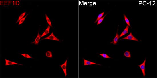 N/A EEF1D Antibody