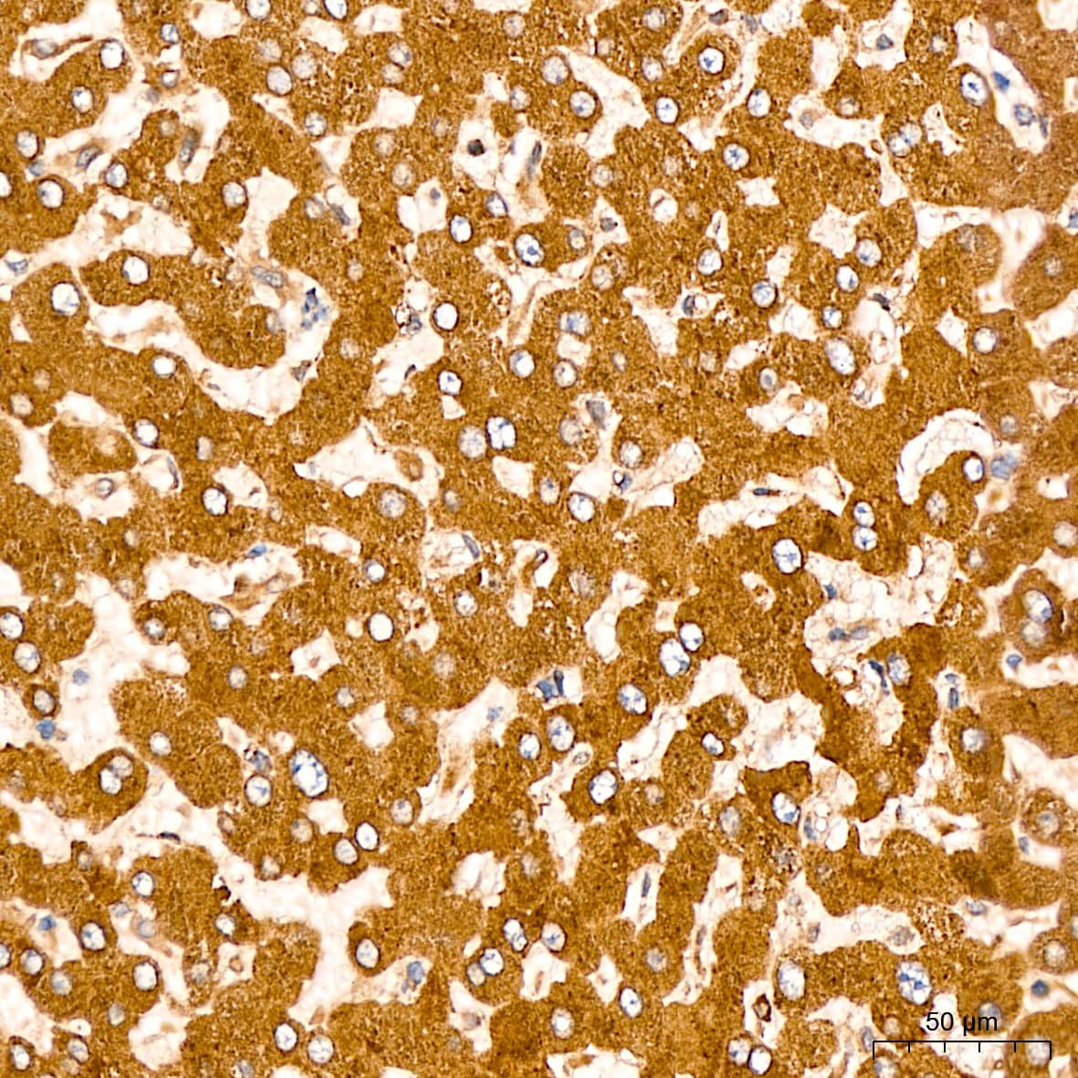 Immunohistochemistry: EEF1D Antibody [NBP3-38001] - Immunohistochemistry analysis of paraffin-embedded Human liver tissue using EEF1D Rabbit pAb at a dilution of  1:200 (40x lens). High pressure antigen retrieval was performed with 0.01 M citrate buffer (pH 6.0) prior to IHC staining.