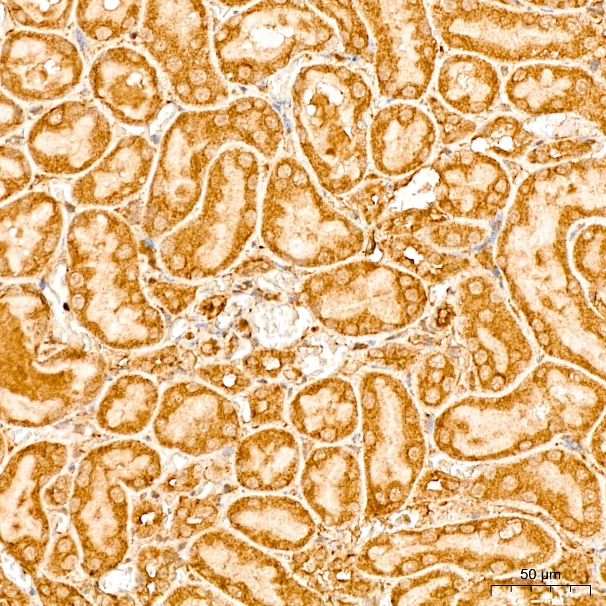 Immunohistochemistry: EEF1D Antibody [NBP3-38001] - Immunohistochemistry analysis of paraffin-embedded Rat kidney tissue using EEF1D Rabbit pAb at a dilution of  1:200 (40x lens). High pressure antigen retrieval was performed with 0.01 M citrate buffer (pH 6.0) prior to IHC staining.