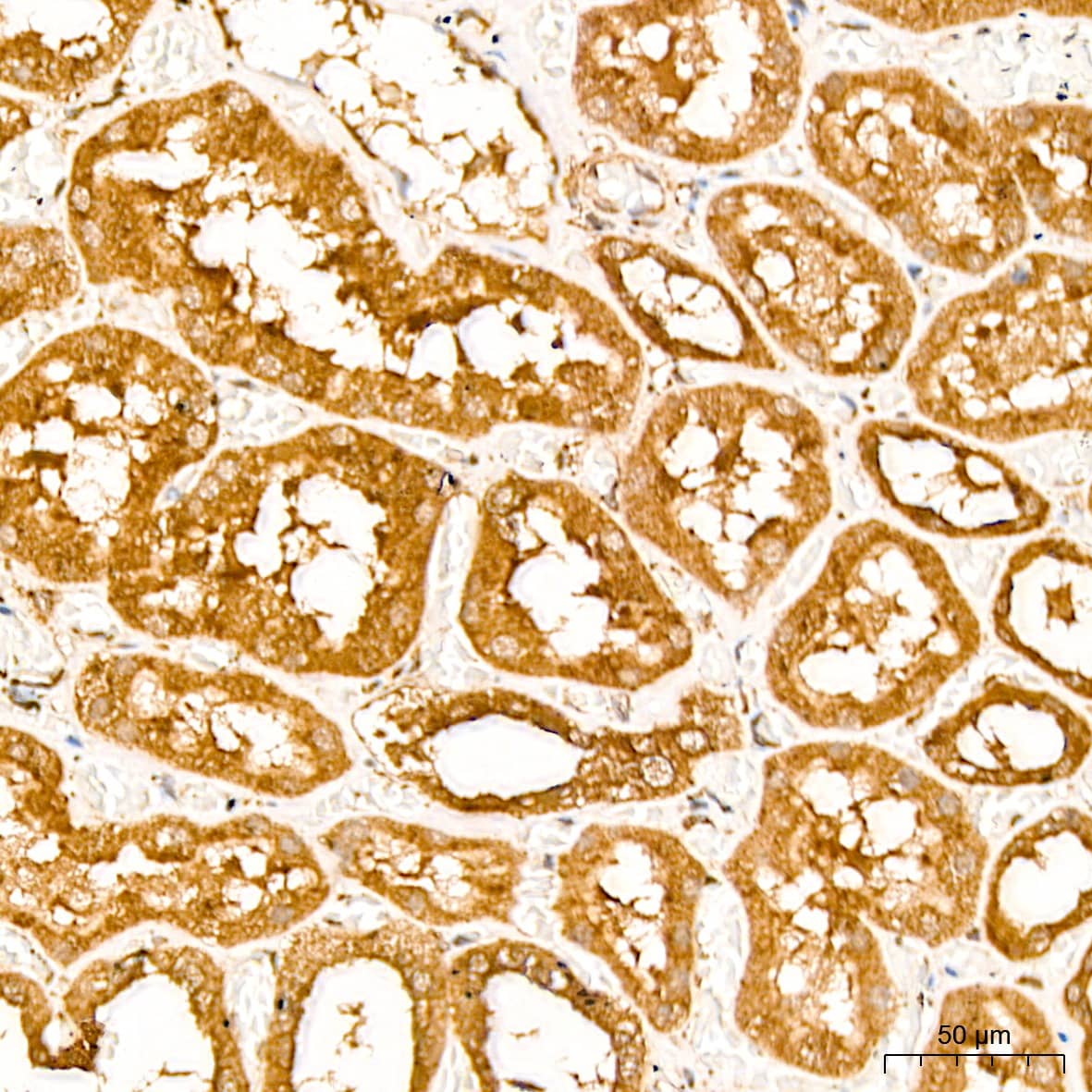 Immunohistochemistry: EEF1D Antibody [NBP3-38001] - Immunohistochemistry analysis of paraffin-embedded Human kidney tissue using EEF1D Rabbit pAb at a dilution of  1:200 (40x lens). High pressure antigen retrieval was performed with 0.01 M citrate buffer (pH 6.0) prior to IHC staining.