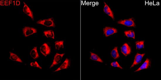 Immunocytochemistry/ Immunofluorescence: EEF1D Antibody [NBP3-38001] - Immunofluorescence analysis of HeLa cells using EEF1D Rabbit pAb at dilution of 1:200 (40x lens). Secondary antibody: Cy3-conjugated Goat anti-Rabbit IgG (H+L) at 1:500 dilution. Blue: DAPI for nuclear staining.