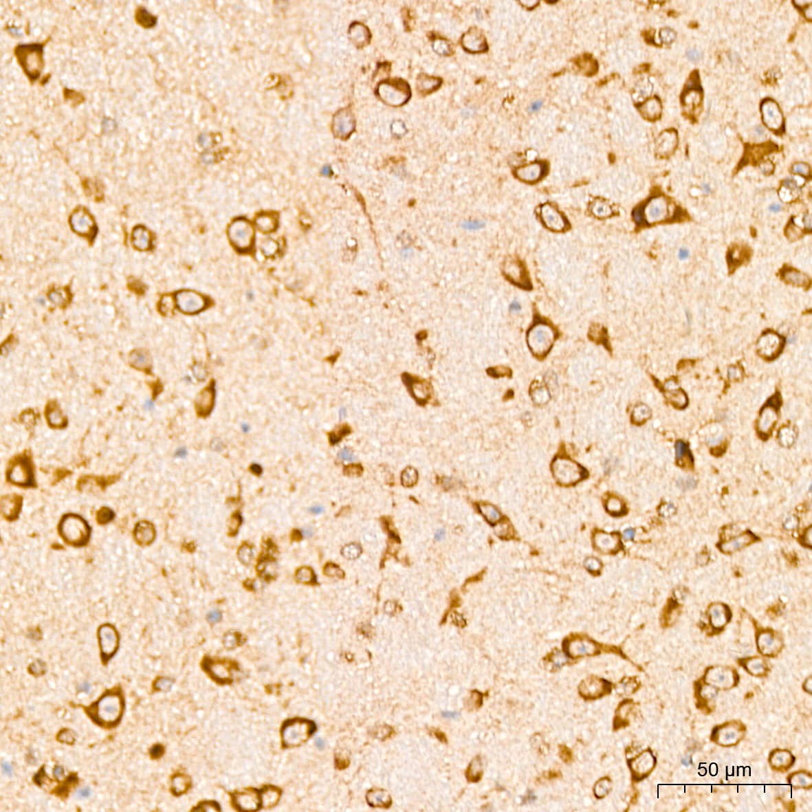 Immunohistochemistry: EEF1D Antibody [NBP3-38001] - Immunohistochemistry analysis of paraffin-embedded Mouse brain tissue using EEF1D Rabbit pAb at a dilution of  1:200 (40x lens). High pressure antigen retrieval was performed with 0.01 M citrate buffer (pH 6.0) prior to IHC staining.