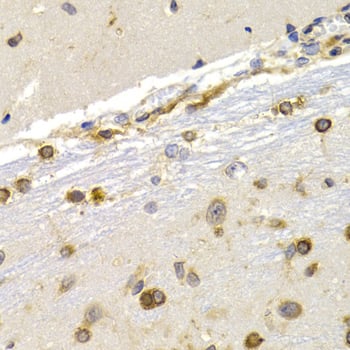 Immunohistochemistry EEF1D Antibody