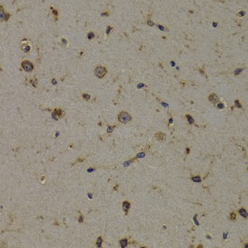 Immunohistochemistry EEF1D Antibody