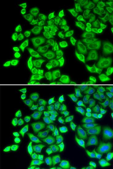 Immunohistochemistry: EEF1D Antibody [NBP3-38001] - Immunohistochemistry analysis of paraffin-embedded Mouse brain tissue using EEF1D Rabbit pAb  at a dilution of  1:200 (40x lens). High pressure antigen retrieval was performed with 0.01 M citrate buffer (pH 6.0) prior to IHC staining.