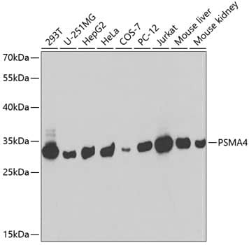 Western Blot: PSMA4 Antibody [NBP3-38003] - Western blot analysis of various lysates using PSMA4 Rabbit pAb at 1:1000 dilution.Secondary antibody: HRP-conjugated Goat anti-Rabbit IgG (H+L) at 1:10000 dilution.Lysates/proteins: 25ug per lane.Blocking buffer: 3% nonfat dry milk in TBST.