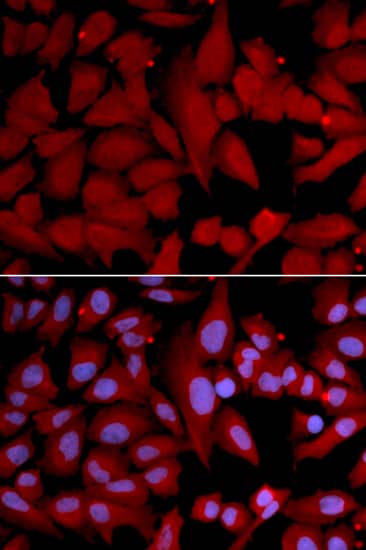 Immunocytochemistry/ Immunofluorescence: PSMA4 Antibody [NBP3-38003] - Immunofluorescence analysis of U2OS cells using PSMA4 Rabbit pAb. Secondary antibody: Cy3-conjugated Goat anti-Rabbit IgG (H+L) at 1:500 dilution. Blue: DAPI for nuclear staining.