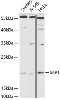 Western Blot: Skp1 Antibody [NBP3-38005] - Western Blot analysis of various lysates using Skp1 Rabbit pAb at 1:1000 dilution.Secondary antibody: HRP-conjugated Goat anti-Rabbit IgG (H+L) at 1:10000 dilution.Lysates/proteins: 25ug per lane.Blocking buffer: 3% nonfat dry milk in TBST.