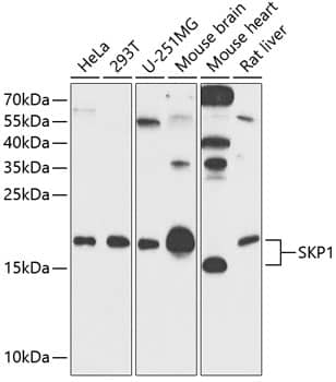 Western Blot: Skp1 Antibody [NBP3-38005] - Western Blot analysis of various lysates using Skp1 Rabbit pAb at 1:500 dilution.Secondary antibody: HRP-conjugated Goat anti-Rabbit IgG (H+L) at 1:10000 dilution.Lysates/proteins: 25ug per lane.Blocking buffer: 3% nonfat dry milk in TBST.Detection: ECL Basic Kit.Exposure time: 90s.