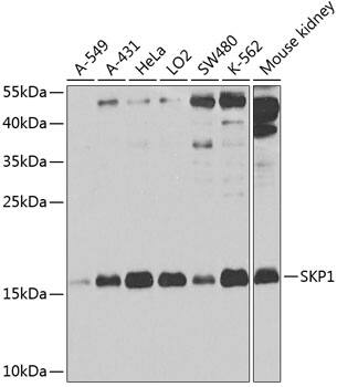 Western Blot: Skp1 Antibody [NBP3-38005] - Western blot analysis of various lysates using Skp1 Rabbit pAb at 1:1000 dilution.Secondary antibody: HRP-conjugated Goat anti-Rabbit IgG (H+L) at 1:10000 dilution.Lysates/proteins: 25ug per lane.Blocking buffer: 3% nonfat dry milk in TBST.