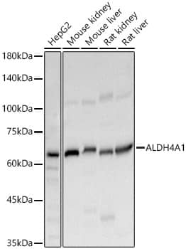 Western Blot: ALDH4A1 Antibody [NBP3-38007] - Western blot analysis of various lysates, using ALDH4A1 Rabbit pAb at 1:6000 dilution.Secondary antibody: HRP-conjugated Goat anti-Rabbit IgG (H+L) at 1:10000 dilution.Lysates/proteins: 25ug per lane.Blocking buffer: 3% nonfat dry milk in TBST.Detection: ECL Basic Kit.Exposure time: 10s.