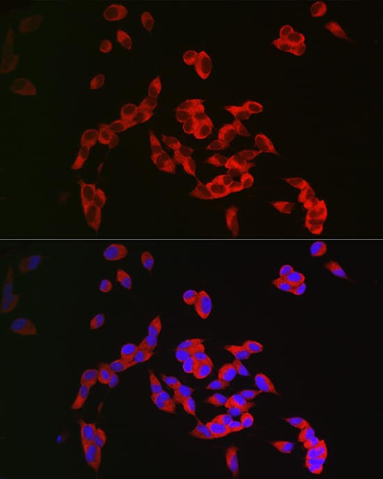 Immunocytochemistry/ Immunofluorescence: CRMP1 Antibody [NBP3-38009] - Immunofluorescence analysis of SH-SY5Y cells using CRMP1 Rabbit pAb at dilution of 1:300 (40x lens). Secondary antibody: Cy3-conjugated Goat anti-Rabbit IgG (H+L) at 1:500 dilution. Blue: DAPI for nuclear staining.