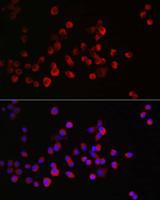 Immunocytochemistry/ Immunofluorescence: CRMP1 Antibody [NBP3-38009] - Immunofluorescence analysis of Neuro-2a cells using CRMP1 Rabbit pAb at dilution of 1:300 (40x lens). Secondary antibody: Cy3-conjugated Goat anti-Rabbit IgG (H+L) at 1:500 dilution. Blue: DAPI for nuclear staining.