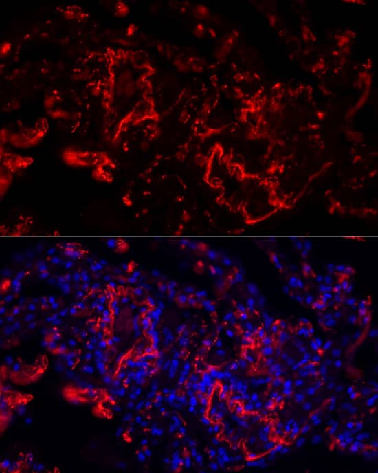 Immunohistochemistry: Elastin Antibody [NBP3-38010] - Immunohistochemistry analysis of paraffin-embedded Human esophagus tissue using Elastin Rabbit pAb  at a dilution of 1:2000 (40x lens). High pressure antigen retrieval was performed with 0.01 M citrate buffer (pH 6.0) prior to IHC staining.