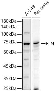 Western Blot: Elastin Antibody [NBP3-38010] - Western blot analysis of various lysates using Elastin Rabbit pAb at  1:1000 dilution.Secondary antibody: HRP-conjugated Goat anti-Rabbit IgG (H+L) at 1:10000 dilution.Lysates/proteins: 25ug per lane.Blocking buffer: 3% nonfat dry milk in TBST.Detection: ECL Basic Kit.Exposure time: 90s.