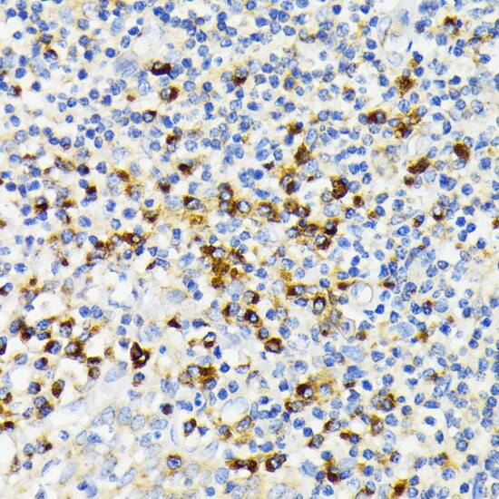 Immunohistochemistry: VDP p115 Antibody [NBP3-38014] - Immunohistochemistry analysis of paraffin-embedded Human tonsil using VDP p115 Rabbit pAb at dilution of 1:100 (40x lens). Microwave antigen retrieval performed with 0.01M PBS Buffer (pH 7.2) prior to IHC staining.