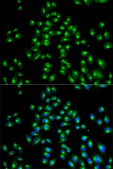 Immunocytochemistry/ Immunofluorescence: VDP p115 Antibody [NBP3-38014] - Immunofluorescence analysis of HeLa cells using VDP p115 Rabbit pAb. Secondary antibody: Cy3-conjugated Goat anti-Rabbit IgG (H+L) at 1:500 dilution. Blue: DAPI for nuclear staining.