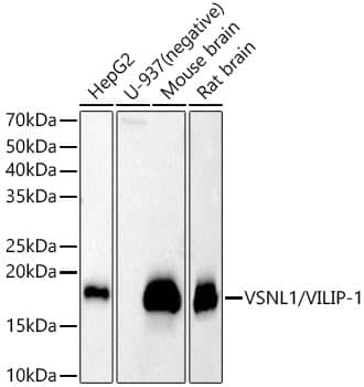 Western Blot: visinin-like 1 Antibody [NBP3-38015] - Western blot analysis of various lysates, using visinin-like 1 Rabbit pAb at  1:400 dilution.Secondary antibody: HRP-conjugated Goat anti-Rabbit IgG (H+L) at 1:10000 dilution.Lysates/proteins: 25ug per lane.Blocking buffer: 3% nonfat dry milk in TBST.Detection: ECL Basic Kit.Exposure time: 30s.