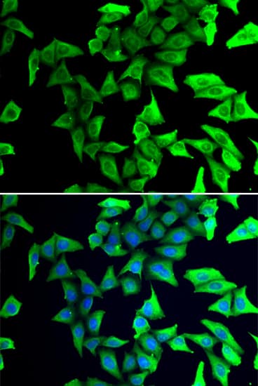 Western Blot: visinin-like 1 Antibody [NBP3-38015] - Western blot analysis of lysates from Mouse brain, using visinin-like 1 Rabbit pAb at  1:1000 dilution.Secondary antibody: HRP-conjugated Goat anti-Rabbit IgG (H+L) at 1:10000 dilution.Lysates/proteins: 25ug per lane.Blocking buffer: 3% nonfat dry milk in TBST.Detection: ECL Basic Kit.Exposure time: 1s.