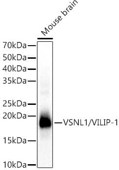 Western Blot: visinin-like 1 Antibody [NBP3-38015] - Western Blot analysis of lysates from Mouse brain, using visinin-like 1 Rabbit pAb at  1:1000 dilution.Secondary antibody: HRP-conjugated Goat anti-Rabbit IgG (H+L) at 1:10000 dilution.Lysates/proteins: 25ug per lane.Blocking buffer: 3% nonfat dry milk in TBST.Detection: ECL Basic Kit.Exposure time: 1s.