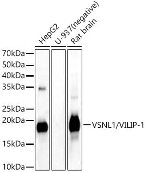 Western Blot: visinin-like 1 Antibody [NBP3-38015] - Western Blot analysis of various lysates, using visinin-like 1 Rabbit pAb at  1:1000 dilution.Secondary antibody: HRP-conjugated Goat anti-Rabbit IgG (H+L) at 1:10000 dilution.Lysates/proteins: 25ug per lane.Blocking buffer: 3% nonfat dry milk in TBST.Detection: ECL Basic Kit.Exposure time: 30s.