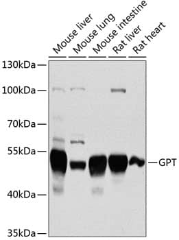 Western Blot: GPT Antibody [NBP3-38016] - Western blot analysis of various lysates using GPT Rabbit pAb at 1:1000 dilution.Secondary antibody: HRP-conjugated Goat anti-Rabbit IgG (H+L) at 1:10000 dilution.Lysates/proteins: 25ug per lane.Blocking buffer: 3% nonfat dry milk in TBST.Detection: ECL Basic Kit.Exposure time: 90s.